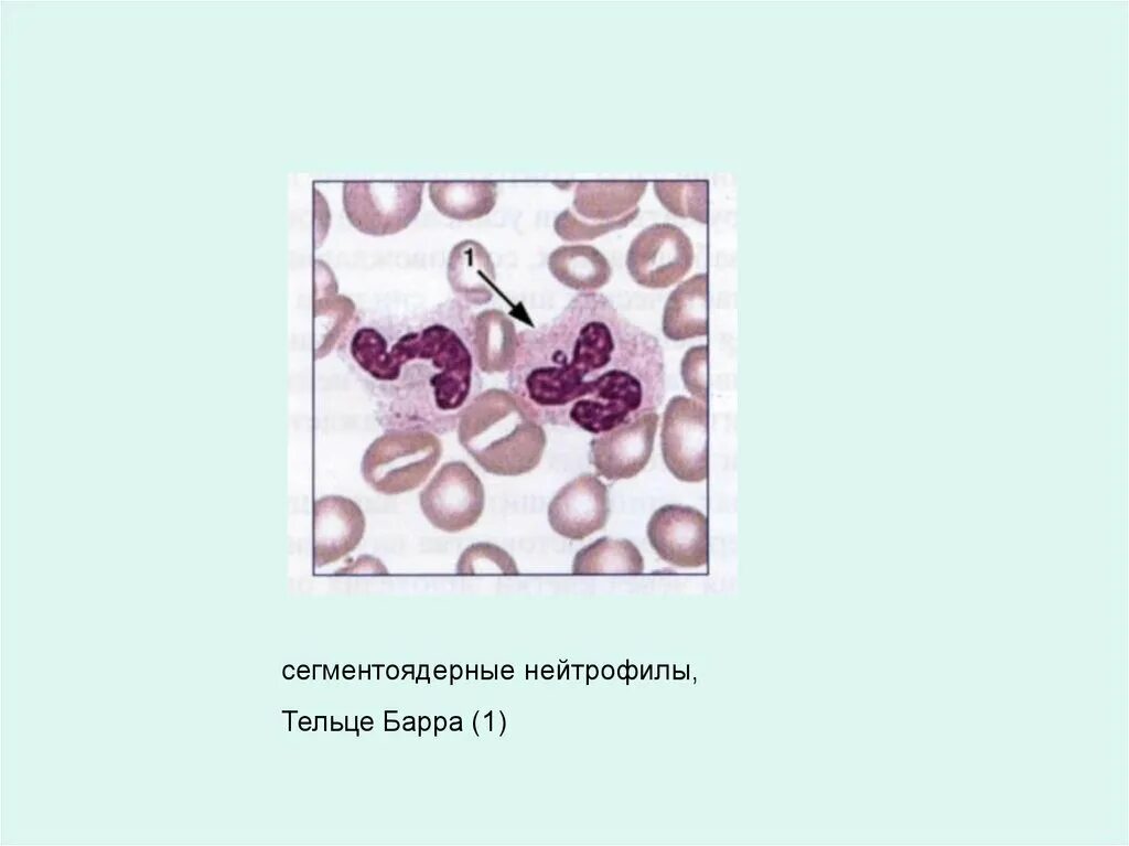 Сегментоядерные нейтрофилы это