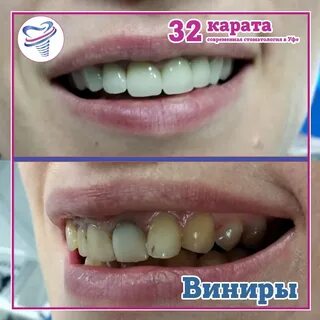 32 карата уфа
