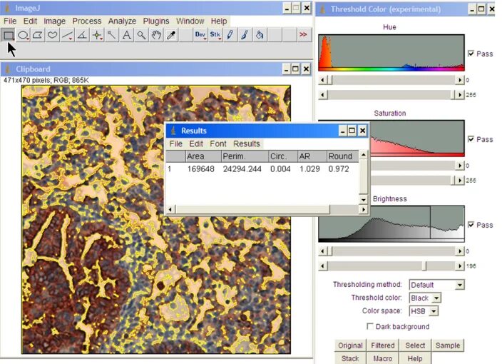 Программа imagej. Imagej программа. threshold analysis. imagej как пользоваться. распределение по размерам imagej.