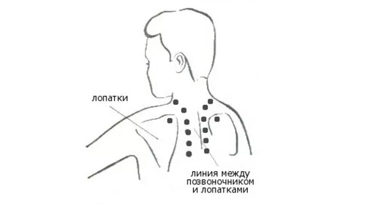 Воротниковый массаж техника выполнения. Точечный массаж при шейном хондрозе схема. Точечный массаж шейно-воротниковой зоны схема. Точечный массаж при хондрозе шейного отдела. Схема массаж шейно-воротниковой зоны.