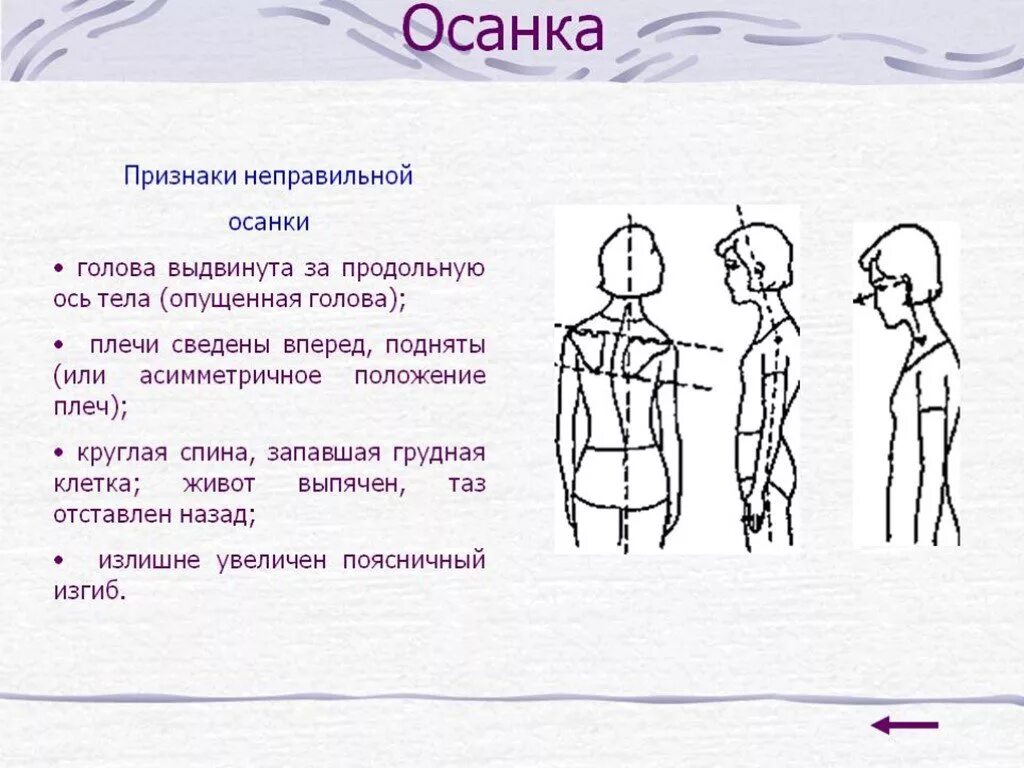 Осанка положение головы. Правильное положение осанки. Правильная осанка. Привычное положение тела непринужденно стоящего. Осанка.