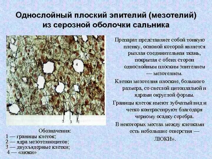 Однослойный мезотелий. Препарат однослойный плоский эпителий мезотелий сальника кролика. Однослойный плоский эпителий брюшины мезотелий сальника. Гистологический препарат мезотелий сальника. Однослойный плоский эпителий мезотелий брюшины препарат.