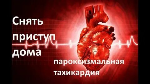 Как снять аритмию