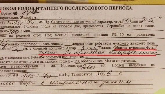 40 недель а родов нет что делать. Петли пуповины в проекции шеи плода. Пуповина вокруг шеи плода. Ребенок в пуповине замотается. Петли пуповины в проекции шеи плода визуализируется.