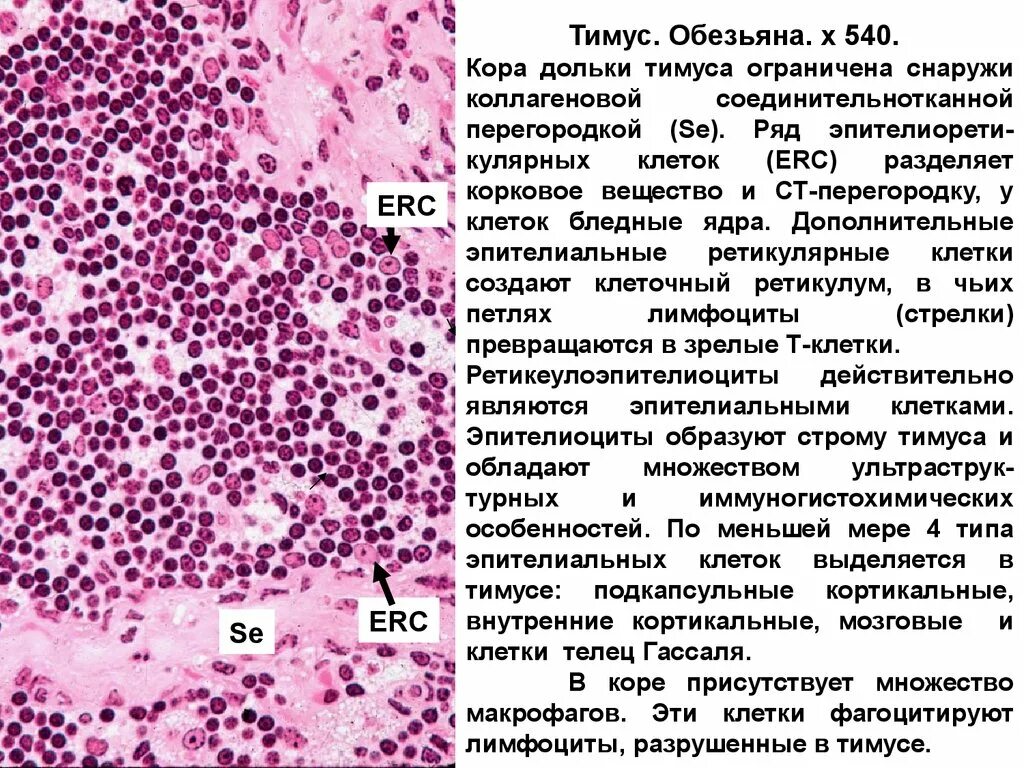 Тимус гистология. Строение тимуса гистология. строение коркового вещества тимуса гистология. корковое вещество тимуса гистология. строение тимуса гистология препарат.