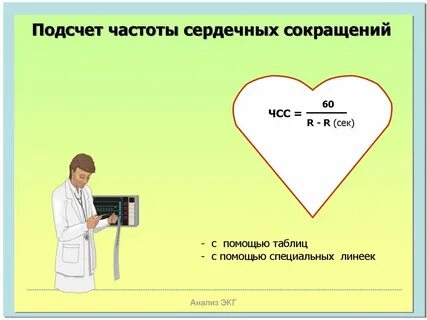 Подсчет частоты сердечных сокращений метод
