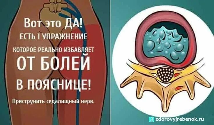 Мне нужен или бандит или военный. Показать седалищный нерв у человека на картинке. Одно просто упражнение!. Скрепящие полы в квартире. Седалищный нерв схема расположения.