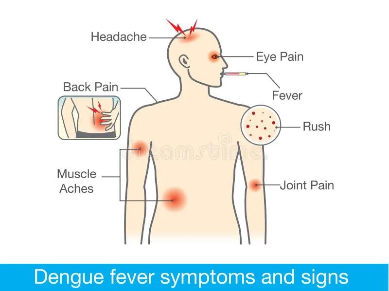 covid-19: Can you get Covid-19 & dengue at the same time? Experts say it's possi