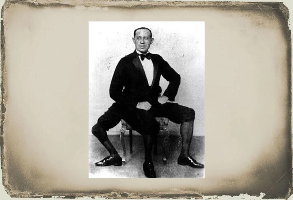 Видит три ноги. Франческо (Фрэнк) Лентини. Франческо Лентини человек с тремя ногами.1889. Трёхногий Фрэнк Лентини. Американец Фрэнк Лентини.