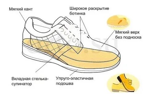Как подобрать ортопедическую обувь взрослому