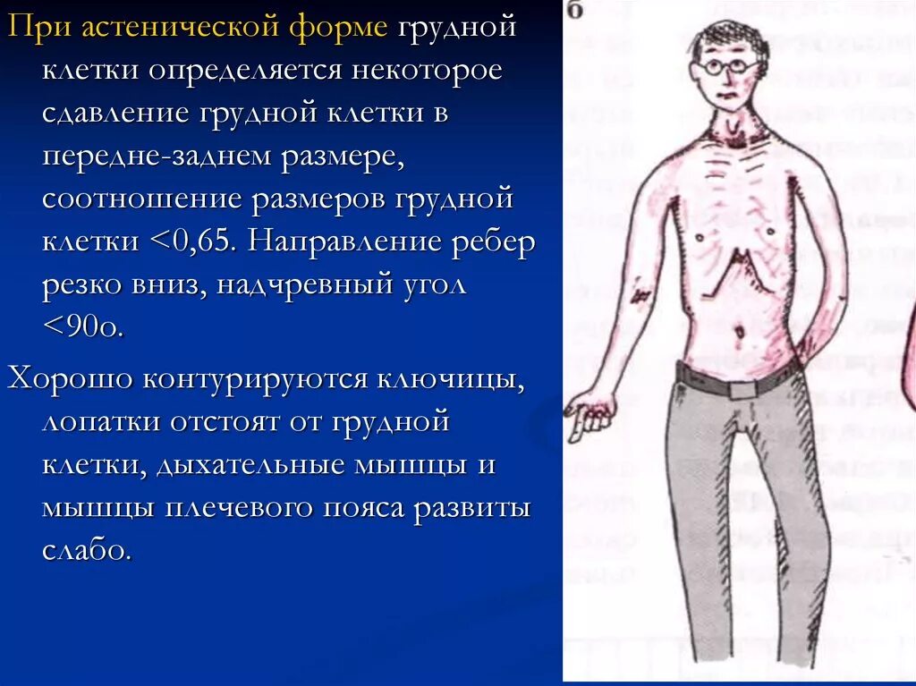 При пальпации грудной клетки определяется болезненность. Пауза грудной клетки. Осмотр грудной клетки в норме. Гиперстеническая форма грудной клетки. Статический и динамический осмотр грудной клетки.