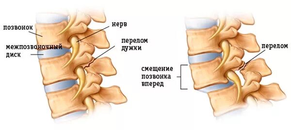 L 5 3