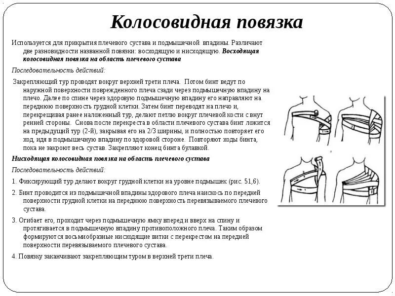 Колосовидная повязка на плечевой сустав алгоритм. Технику наложения колосовидной повязки на плечевой сустав. Наложение колосовидной повязки на плечевой сустав алгоритм. Алгоритм наложения колосовидной повязки на плечевой.