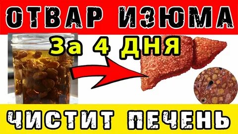 Помощь печени изюмом