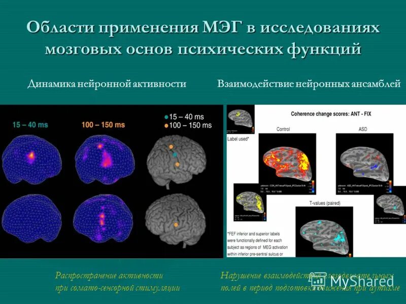 методика исследования рефлексов. виды исследований головного мозга. функциональная томография головного мозга. методы исследования головного мозга. метод изучения мозга.