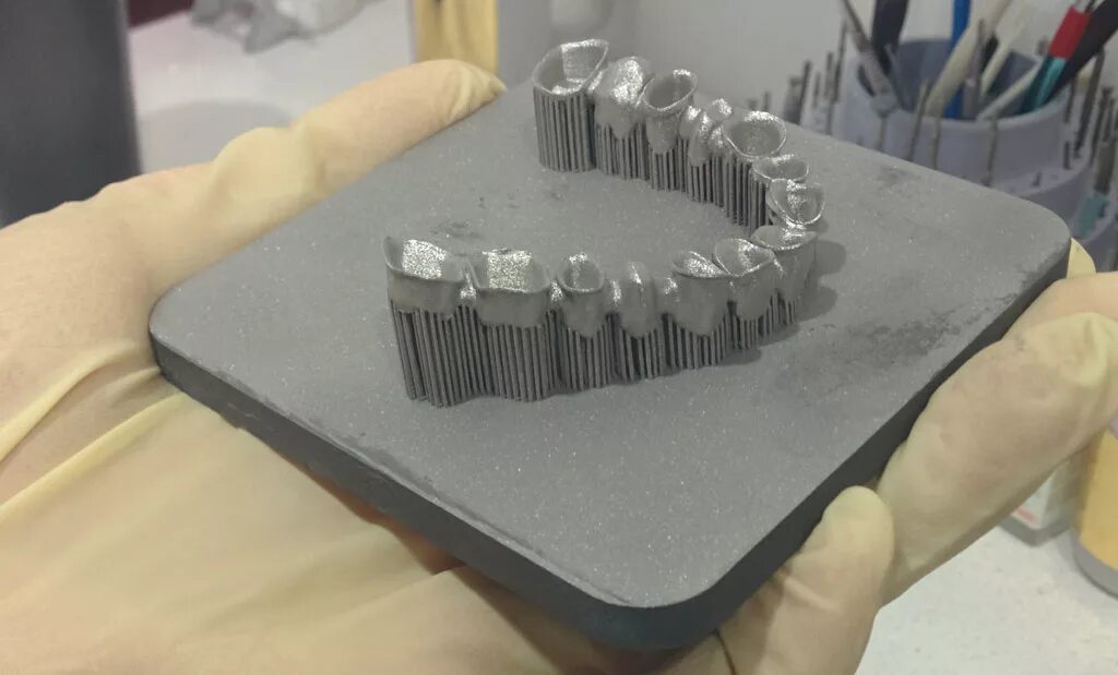 лазерное спекание металла в стоматологии. зуботехнический аппарат лазерного спекания. лазерное спекание металла в стоматологии. селективное лазерное спекание. лазерное спекание в стоматологии.