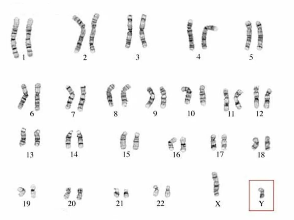 Зубы и хромосомы. Тату хромосома. human karyotype. простые тату хромосома. хромосомы свиньи.