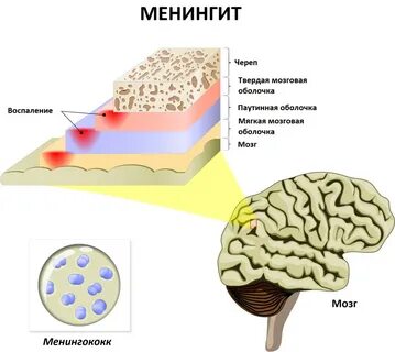 Воспаление оболочек