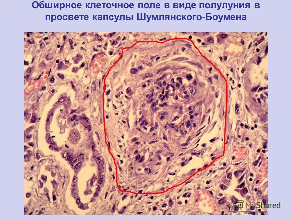 Печень человека гистология триада. Небная миндалина гистология препарат. Почечный клубочек гистология. Гистология почки норма. Строение паращитовидной железы гистология.