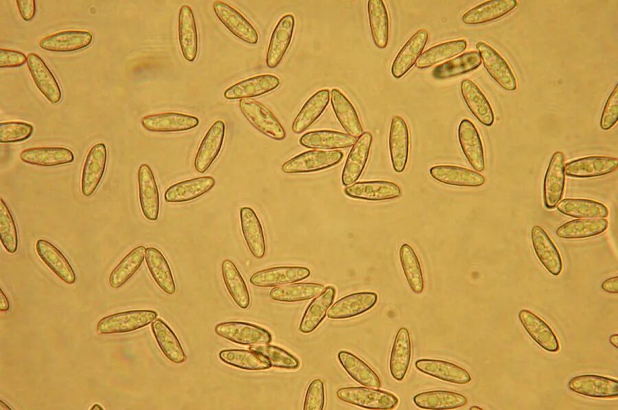 Микроскопия кала дрожжи. Микроскопия кала дрожжевые грибки. Микроскопия кала споры грибов. Споры грибов в Кале микроскопия. Грибы в кале копрограмма
