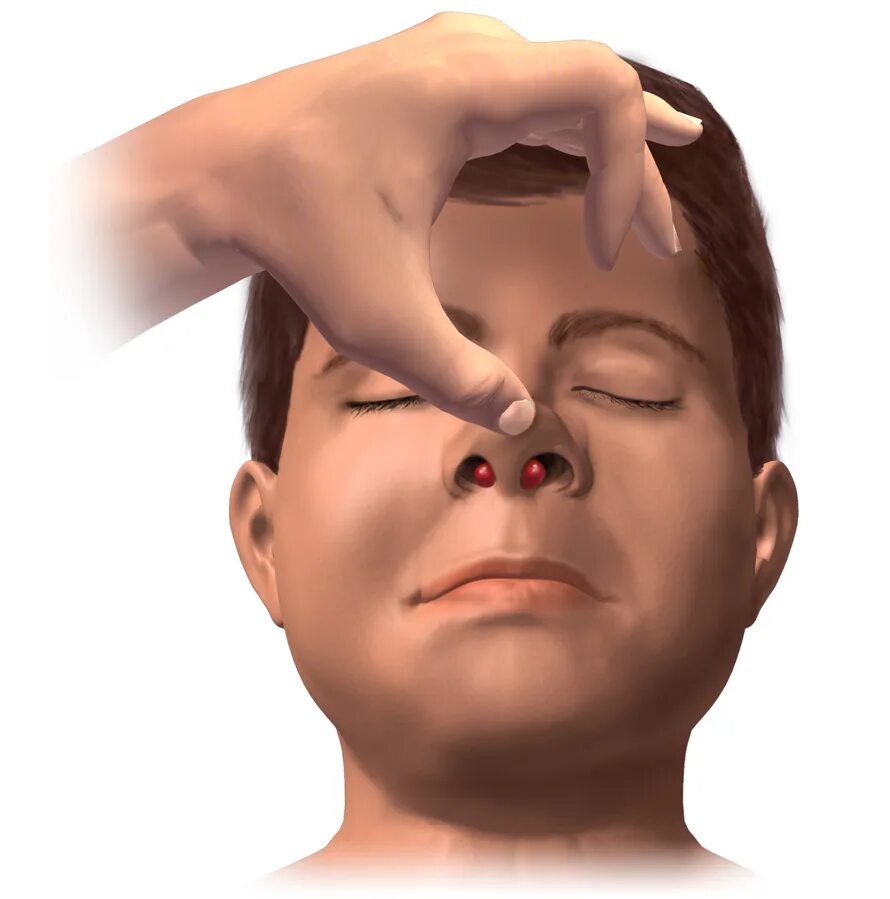 Edema is a medical term for an abnormal accumulation of fluid in certain tissues