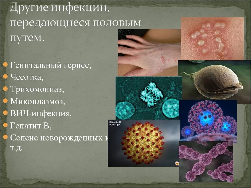 Заболевания кожи инфекции. Вирусные заболевания половым путем