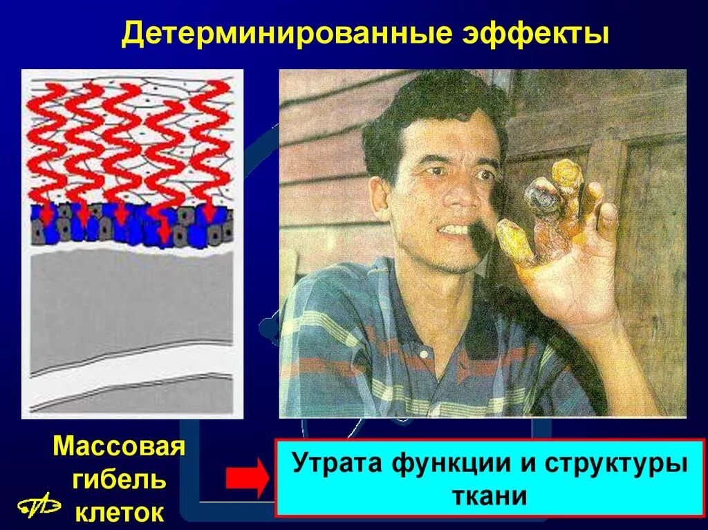 Детерминированные эффекты ионизирующего излучения. Детерминированные эффекты. детерминированные биологические эффекты. детерминированных эффектов ионизирующего излучения. детерминированные действия это.
