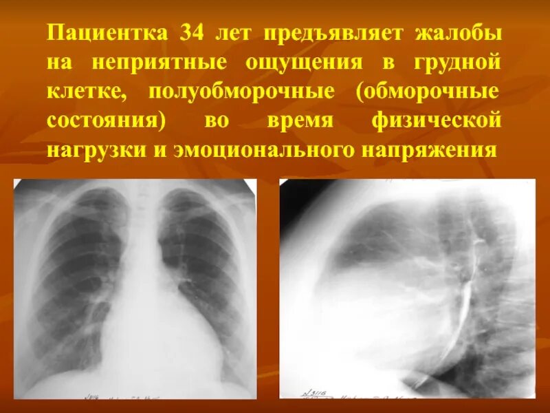 Неприятные ощущения в грудной. Неприятные ощущения в грудной клетке. Странное ощущение в грудной клетке. Ощущение кома в грудной клетке. Скованность в грудной клетке.