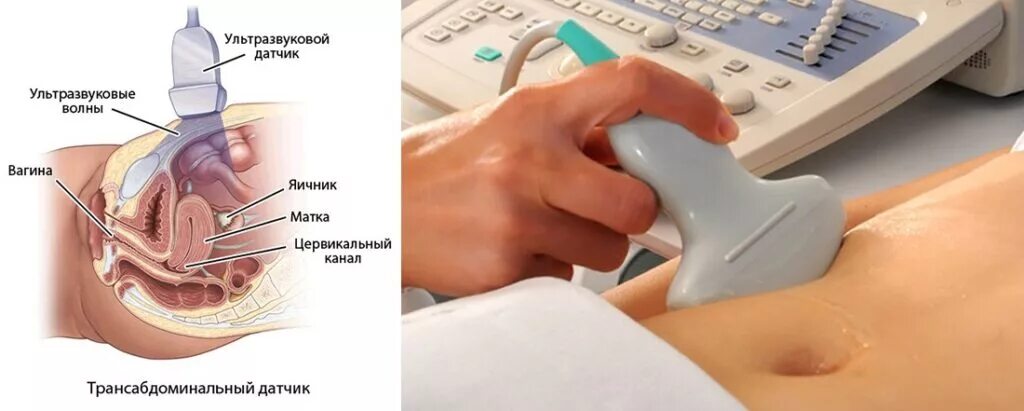 Записаться на узи малого таза