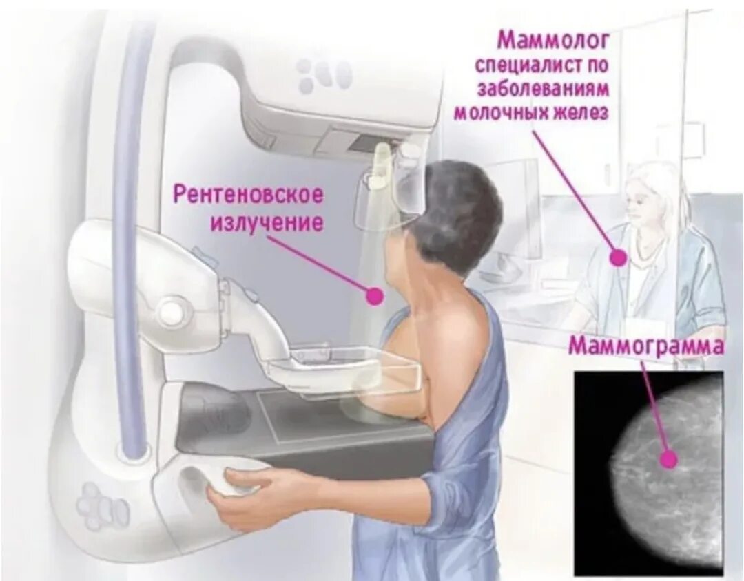 Маммография молочных желез на какой