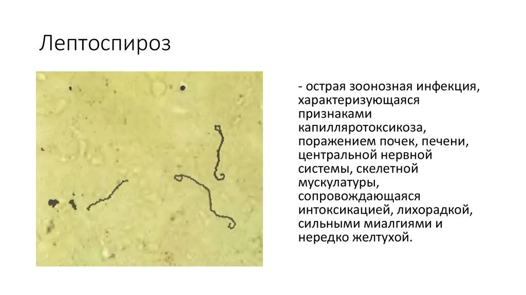 Лептоспироз животных. Лептоспироз переносчики инфекции. лептоспироз (возбудитель болезни относятся к виду leptospira interrogans). безжелтушный лептоспироз. лептоспироз резервуар возбудителя.