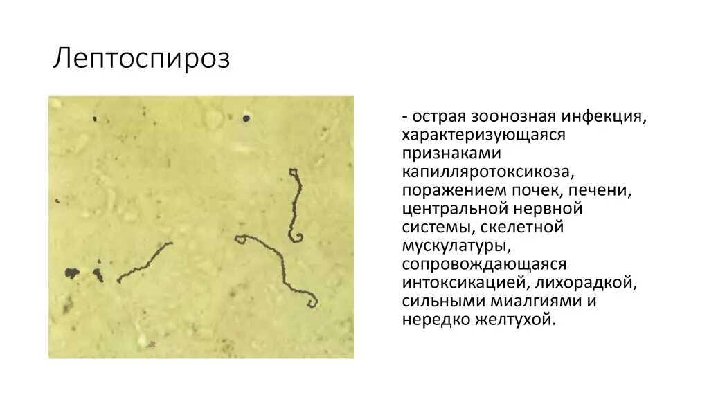 Лептоспироз это что за болезнь. Лептоспироз переносчики инфекции. Возбудитель лептоспироза микробиология кратко. Характерный симптомокомплекс лептоспироза. Лептоспироз (возбудитель болезни относятся к виду Leptospira interrogans).