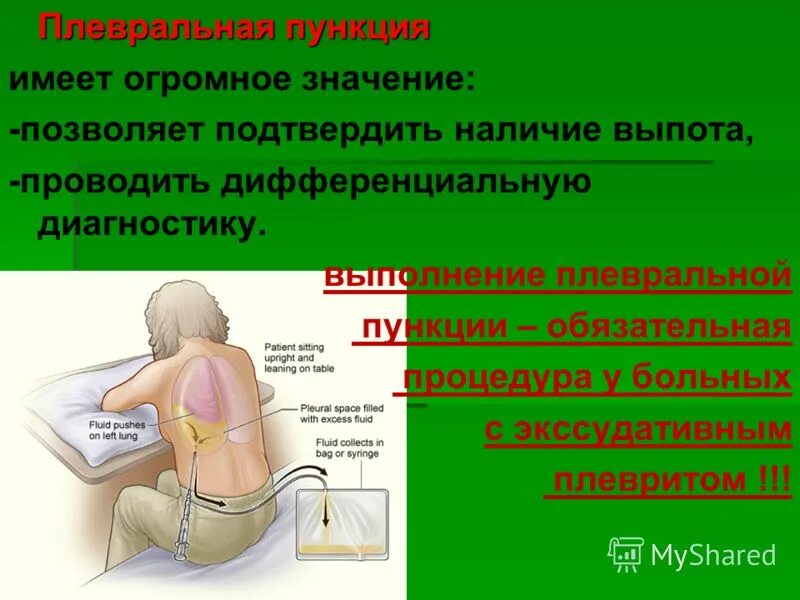 Понижение давления в плевральной полости. Диагностическая плевральная пункция алгоритм. Показания к пункции плевральной полости. Подготовка пациента к плевральной пункции. Методика выполнения плевральной пункции.