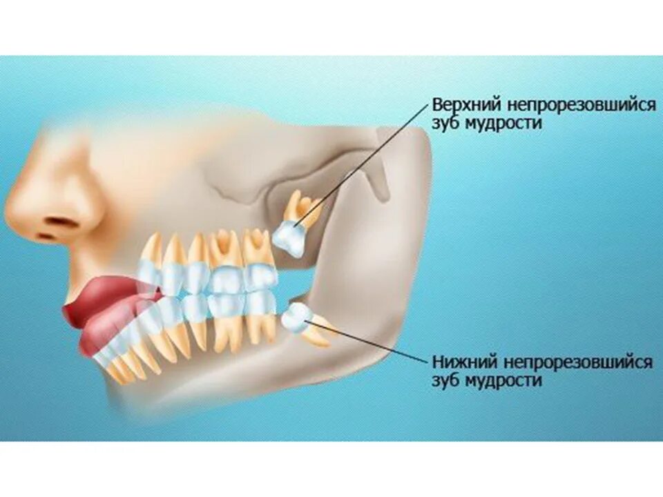 Количество вырвать. Зуб мудрости оперировали. Количество электронов вырываемых светом с поверхности металла. Количество вырвать. Число фотоэлектронов в единицу времени.