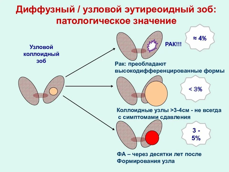 Многоузловой диффузный. Многоузловой эутиреоидный зоб. Узловатый гипертиреоидный зоб. Узловой и многоузловой зоб.