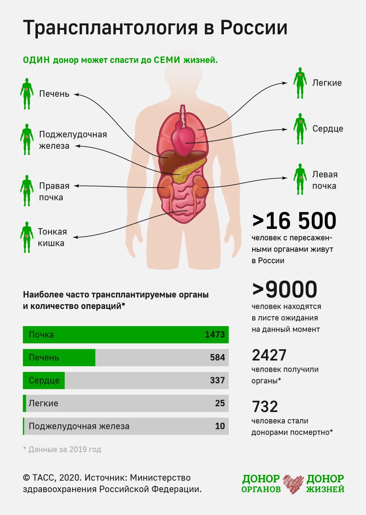 Трансплантология почки. Трансплантация органов почки. Сколько стоит донорство почки. Актуальность трансплантации почки. Почка человека донор.