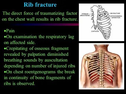 Ribs песня