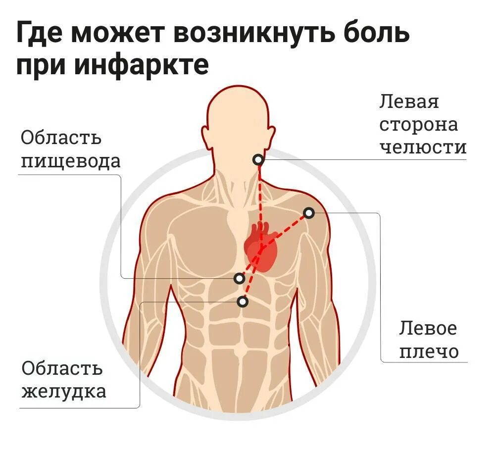 Локализация боли в сердце. Локализация сердечной боли. Боли в сердце симптомы. Почему болит сердце.