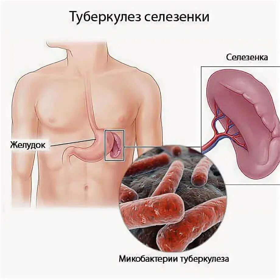 Селезенка человека. Органы человека селезенка.