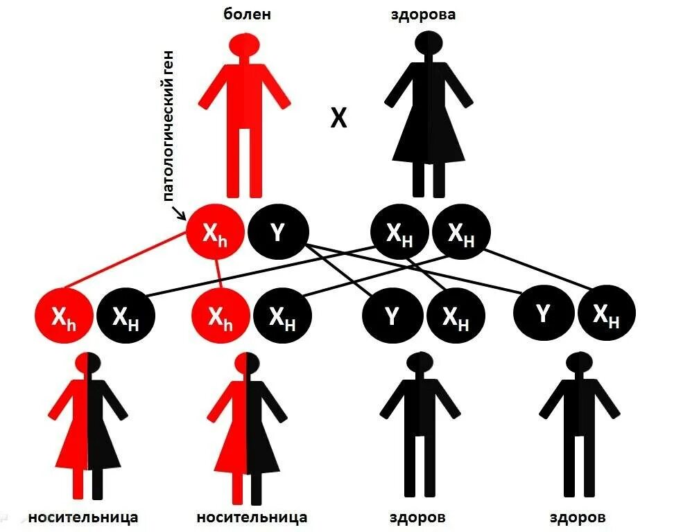 Болезни передающиеся по наследству от матери. Схема наследования гемофилии. Схема передачи гемофилии по наследству. Гемофилия передается по наследству. Гемофилия Тип наследования.