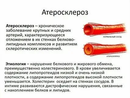 Стенозирующее образование. Стенозирующее образование