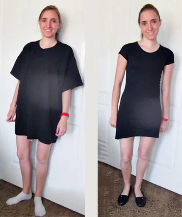 платье из большой футболки. оригинальные платья своими руками. платье из футболки без шитья. как платье сделать более. платье из мужской рубашки без шитья.