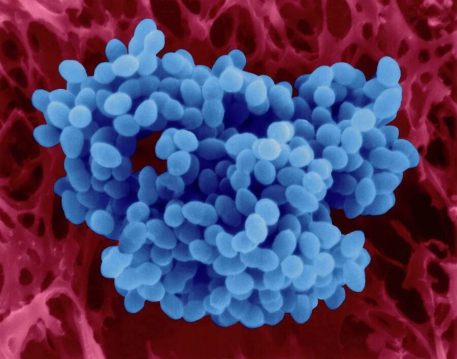 Enterococcus 10 в 5
