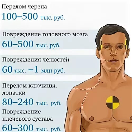 Мужские яйца цена сколько. Расценка органов человека. Стоимость органов человека мужчины. Сколько стоят органы. Стоимость органов в России.