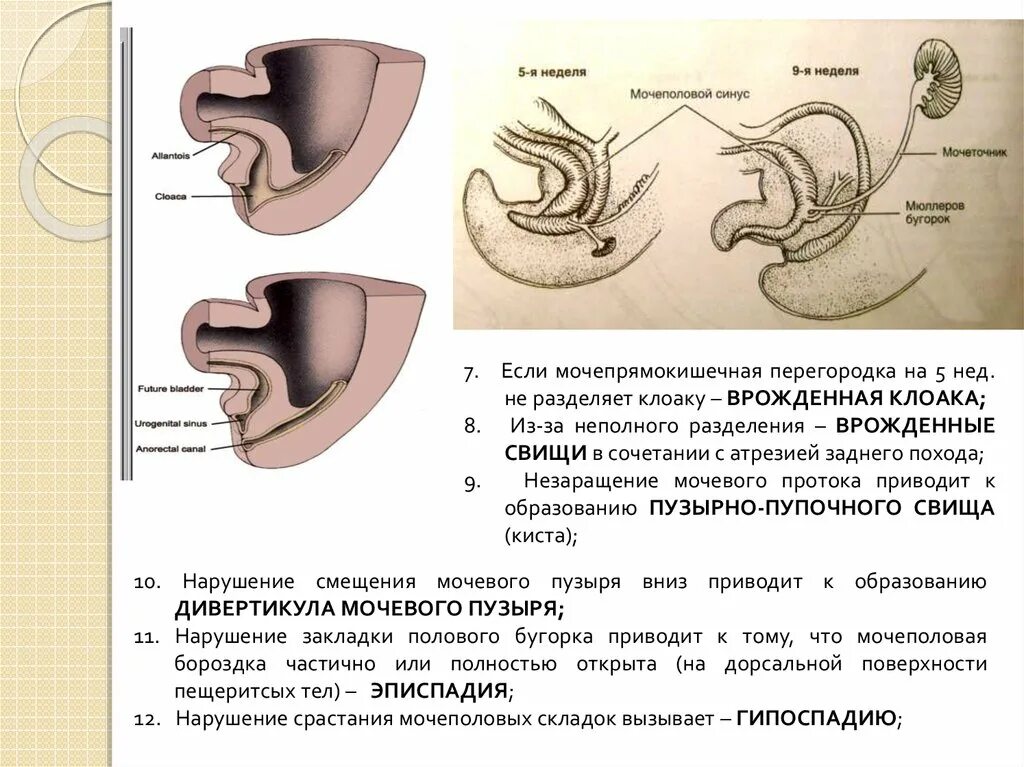 Футболка микропенис. Врожденные дефекты мочевыделительной системы. Пороки мочевыделительной системы. Пороки развития мочеполовой системы. Пороки развития полового члена.