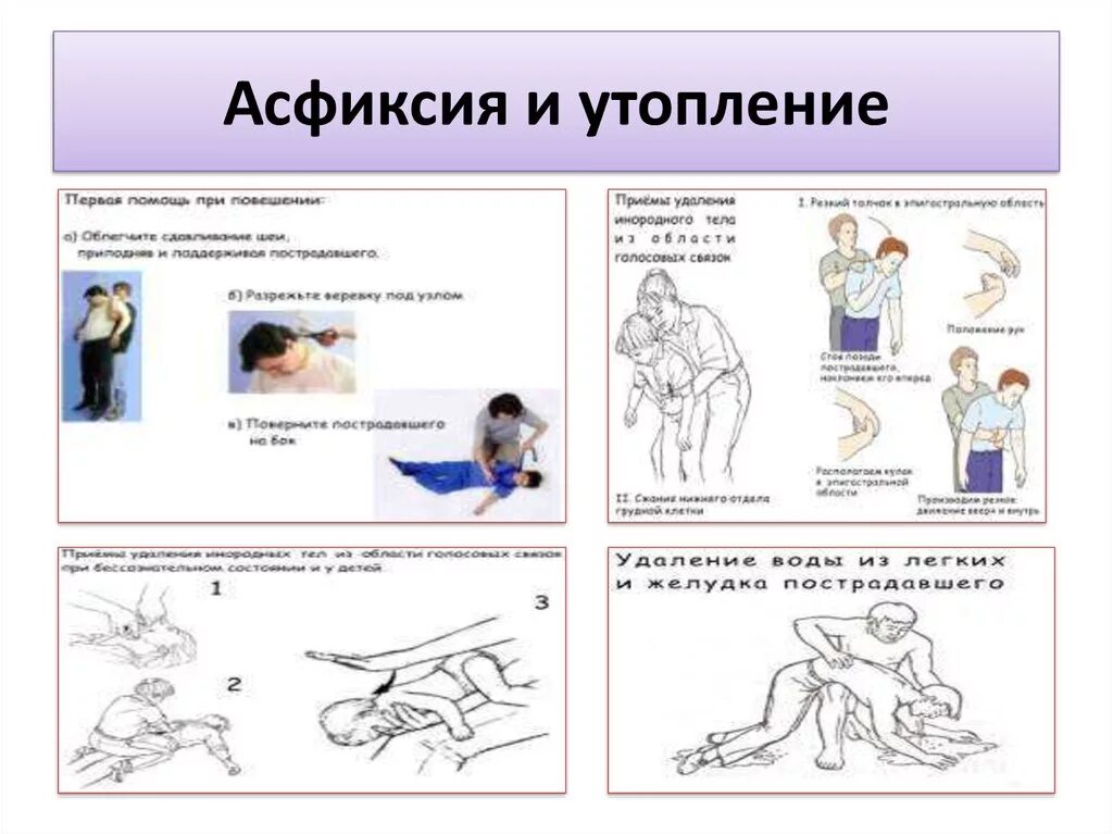 Асфиксия алгоритм. Алгоритм при асфиксическом утоплении. Асфиксия при утоплении. Первая помощь при асфиксии утоплении. Первое мероприятие при асфиксическом утоплении:.