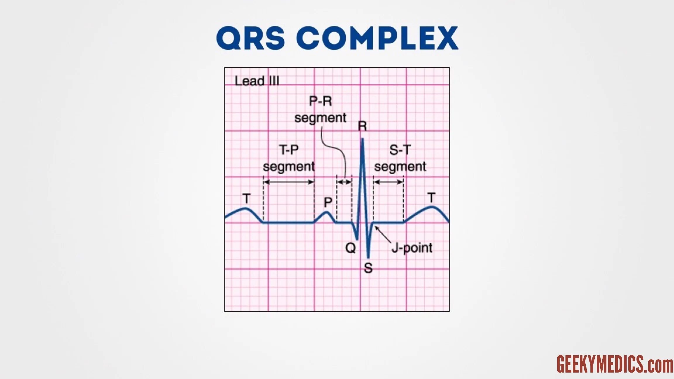 Qrs на экг что это. Расшифровка ЭКГ QRS. Комплекс QRS на ЭКГ норма. ЭКГ комплексы расшифровка. Сегмент QRS на ЭКГ.