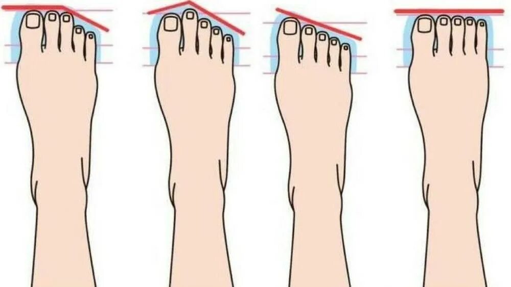 Типы стопы человека. Форма пальцев на ногах. Египетская форма стопы. Греческая форма стопы. Форма пальцев стопы.