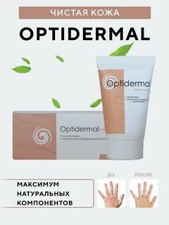 Оптидермал от псориаза