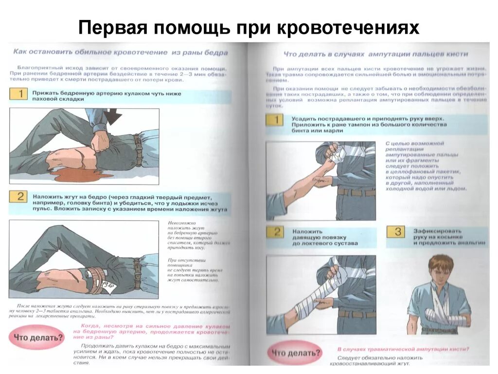 Правила оказания первой при кровотечении. Оказание первой помощи при ранениях и кровотечениях. Оказание первой помощи пострадавшему при кровотечении. Первая помощь при при кровотечениях. Оказание первой медицинской при кровотечении.